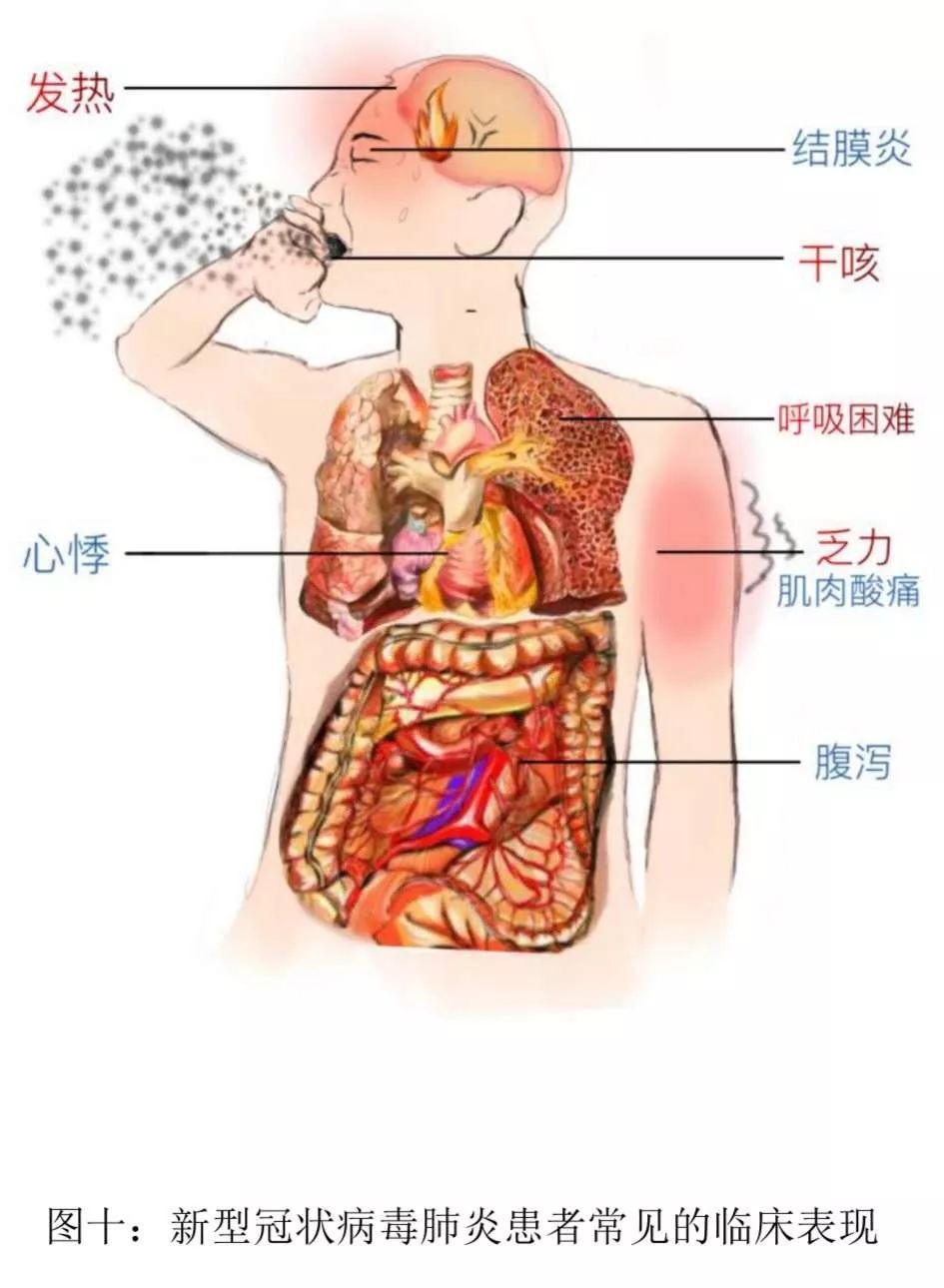 全球关注焦点，新型冠状病毒最新动态概览